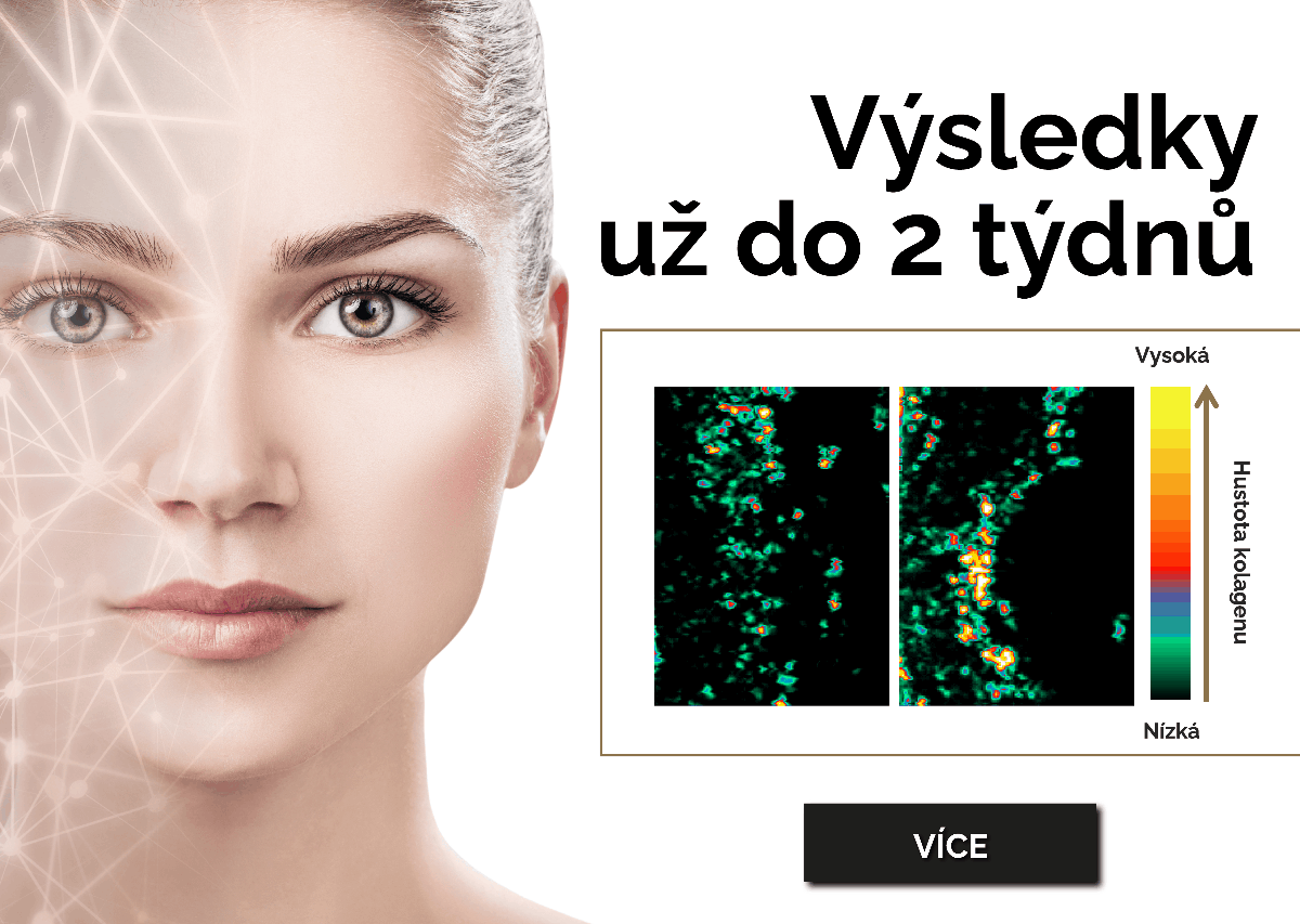 Orca collagen | kolagen s výsledky do 2 týdnů