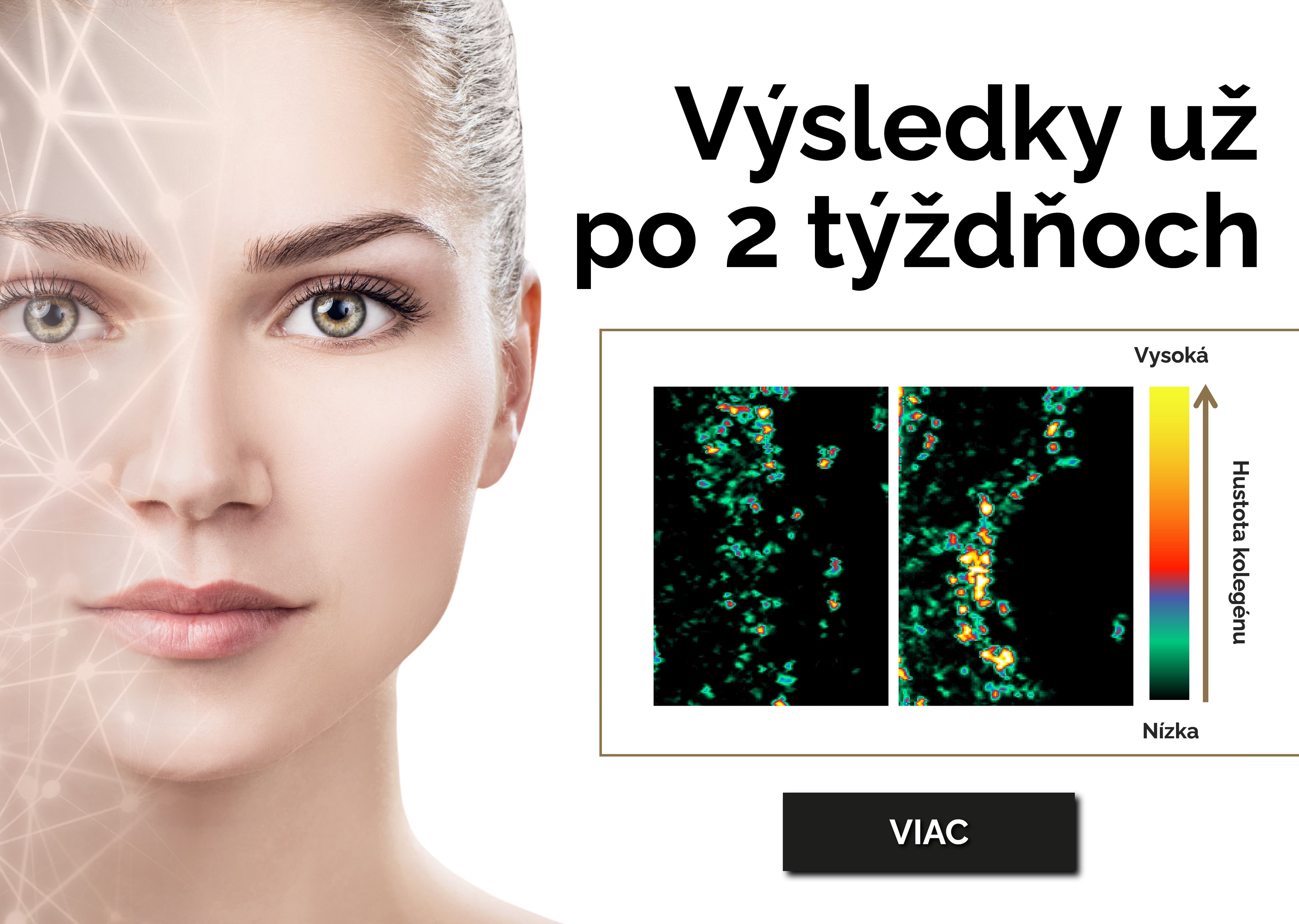 Orca collagen | kolagén s výsledkami do 2 týždňov