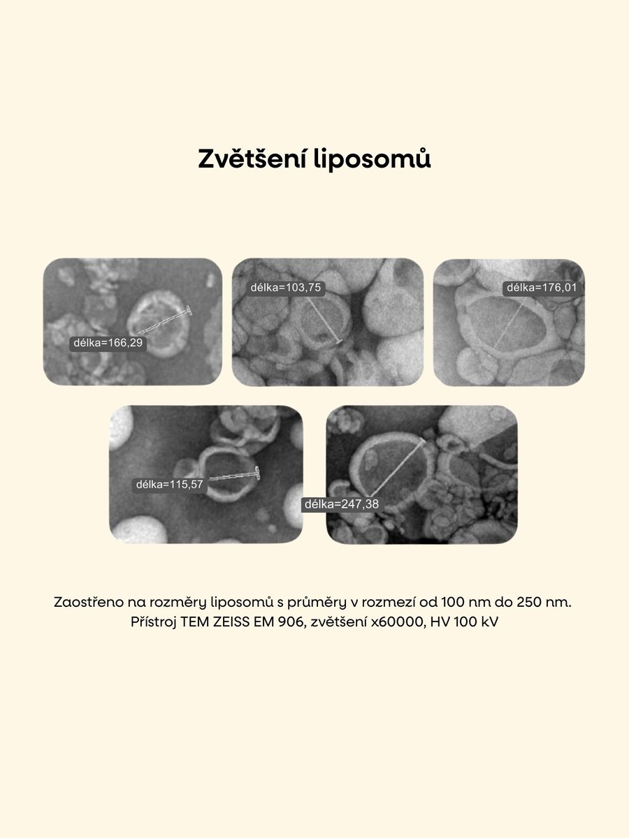 Zvětšení liposomů pod elektronovým mikroskopem