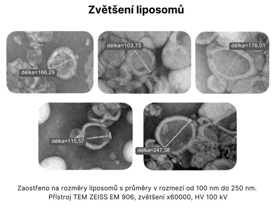 Zvětšení lipozomů – snímky z elektronového mikroskopu TEM s naměřenými rozměry 100 až 250 nm