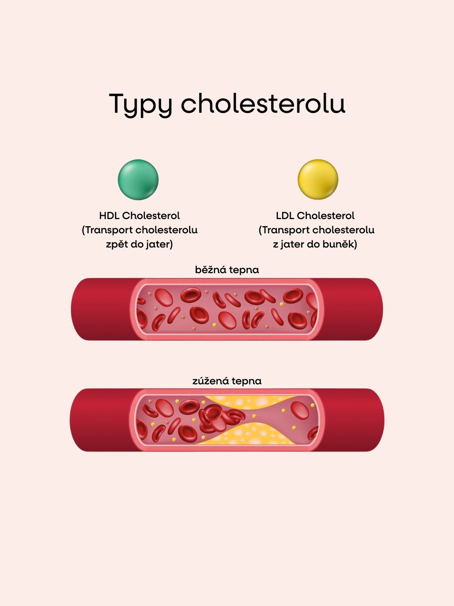 Typy cholesterolu