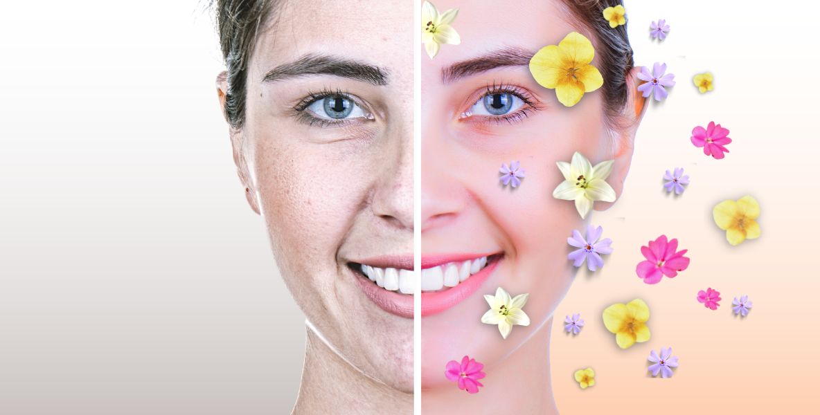 Peeling: probuďte pleť ze zimního spánku