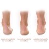 asymetrical heel supports s v (4)