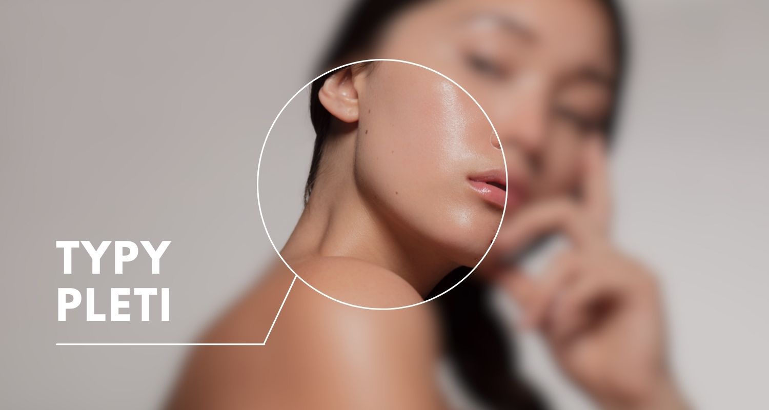 Typy pleti. Poznáte ten svoj?