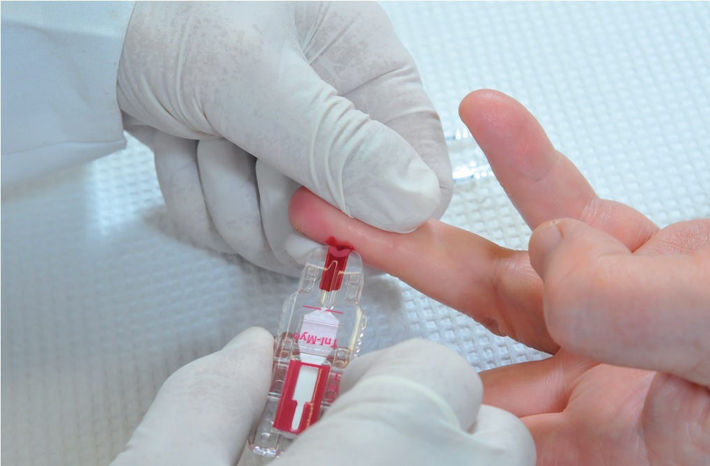 krevni-test-odber
