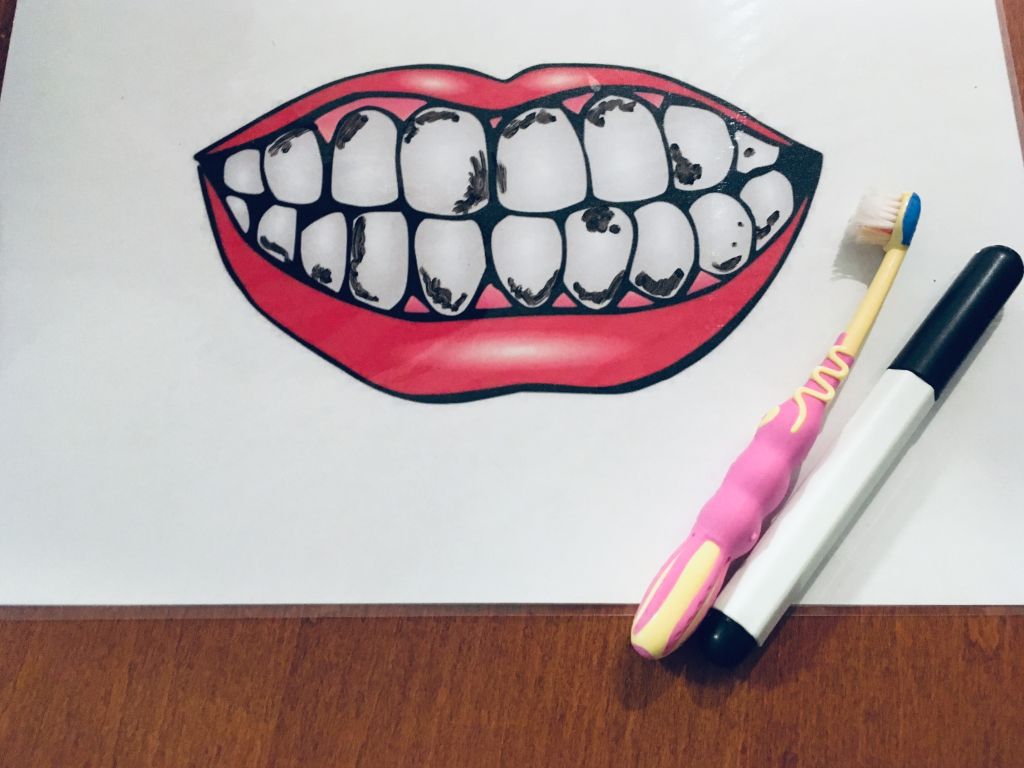 Čistíme si zuby, alebo ako deťom vysvetliť, že si ich fakt treba čistiť