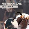 Nalepovacie pätičky do topánok proti oderom 2 ks S-BA0005