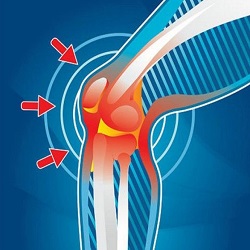 BOLESTI KOLENE - je účinný laser?