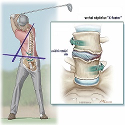 Jak GOLF vede k časné LUMBÁLNÍ DEGENERACI