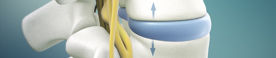 Spinal_Decompression1084x229
