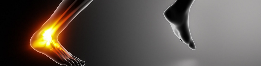 achiles_tendon1084x276