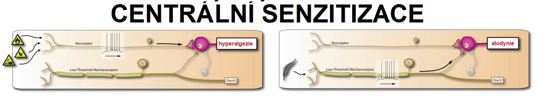 central_sensitisationCZ1084x198