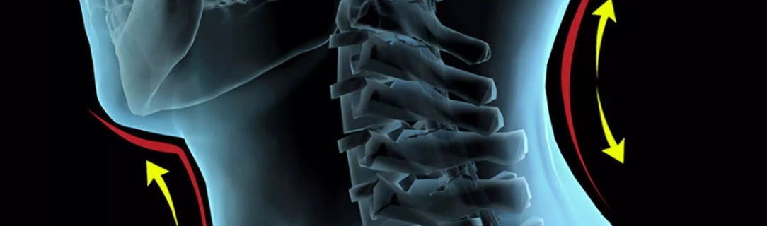 cervical_traction1084x320