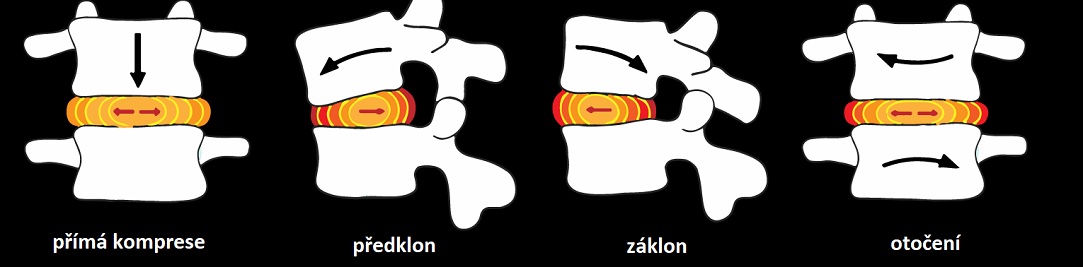 disc_compression1083x267