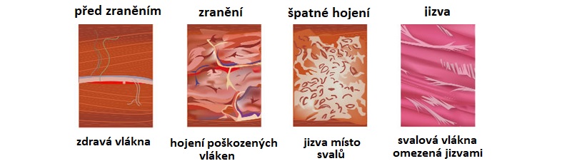 muscle_healing787x233