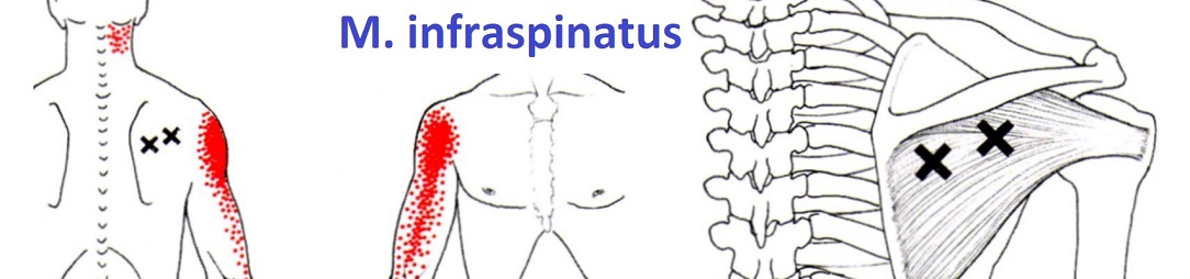 shoulder_TP_infraspinatus1084x254