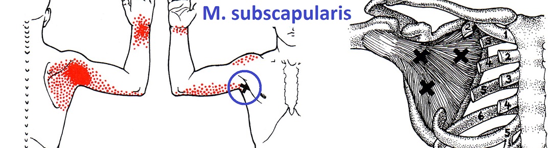 shoulder_TP_subscapularis_1084x291