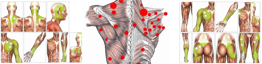 triggerpoints1084x268