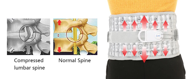 BackBrace_discs