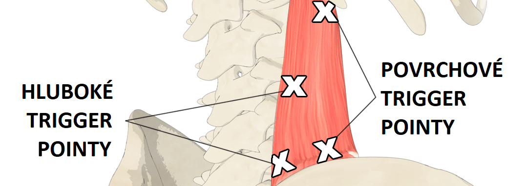 quadratus-lumborum-TP2cz-1084X382