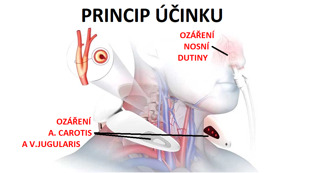 cervishinenasalCZ1082x511