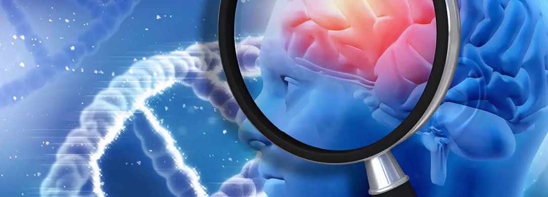 brain_stroke_1084x390