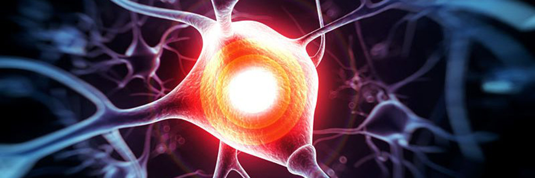 fibromyalgie