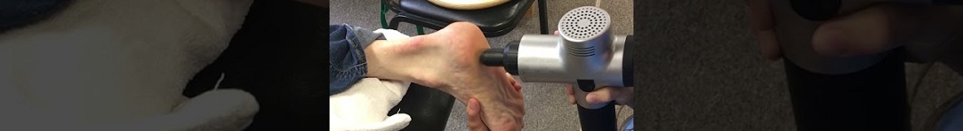 plantar-fasciitis_10_1083x148