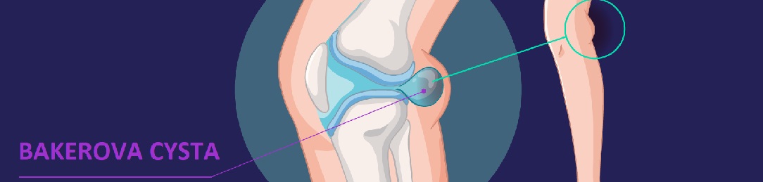 BAKEROVA_CYSTA1084x259