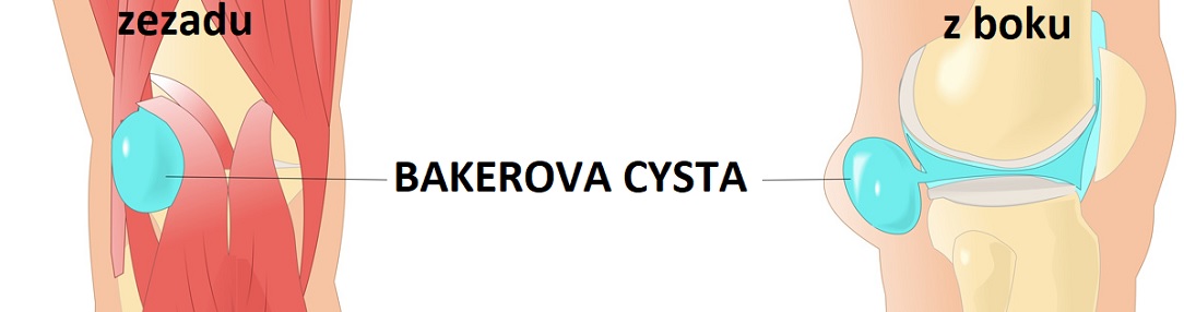 BAKEROVA_CYSTA1084x286