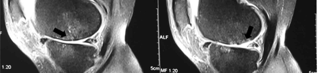 KNEE-MRI1084x251