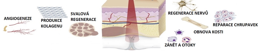 Laser-effect1084x210