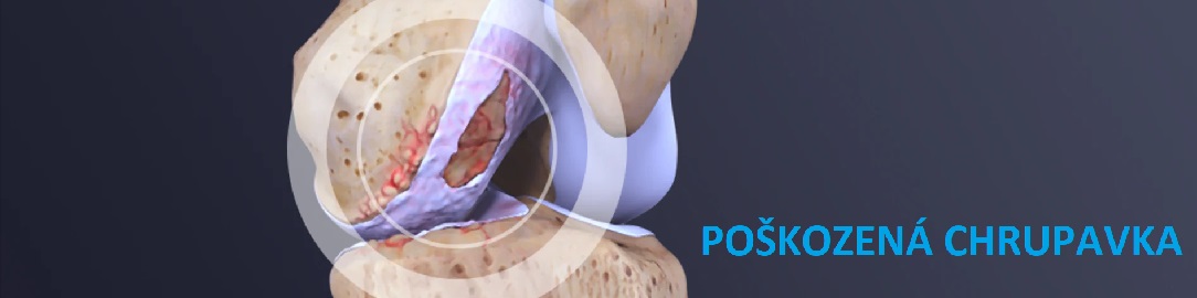 POSKOZENA_CHRUPAVKA1084X270