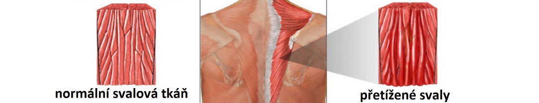 StrainedMuscles1084x207