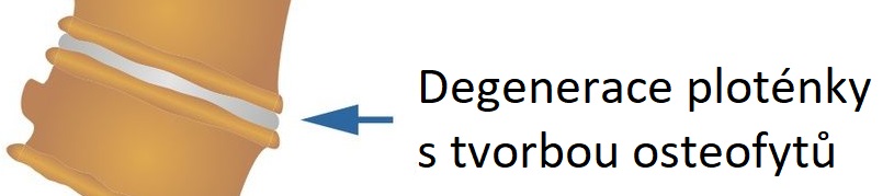 degen_dicsCZ6osteo1083