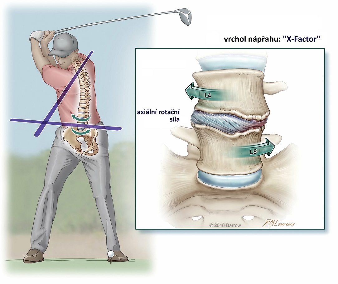 golf_lumbar_degenerationTopCZ1084x911