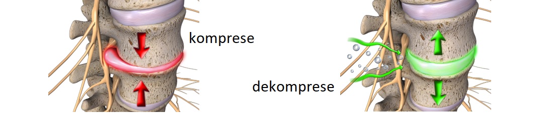 komp_dekomp