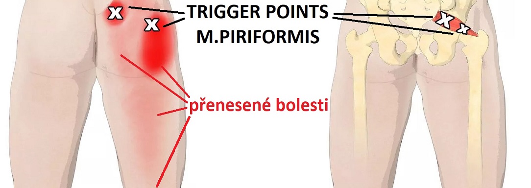 m_piriformis_TP_CZ1084x384