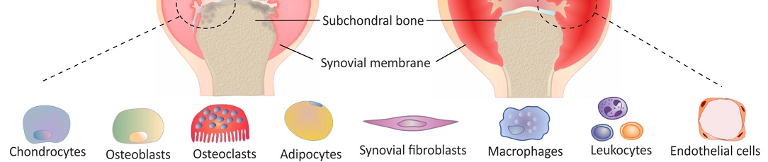 metabolism_disorder1084x229