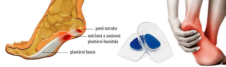 podpatěnky TULI´S® Polar Bears™ Dual Density Heel Cups™