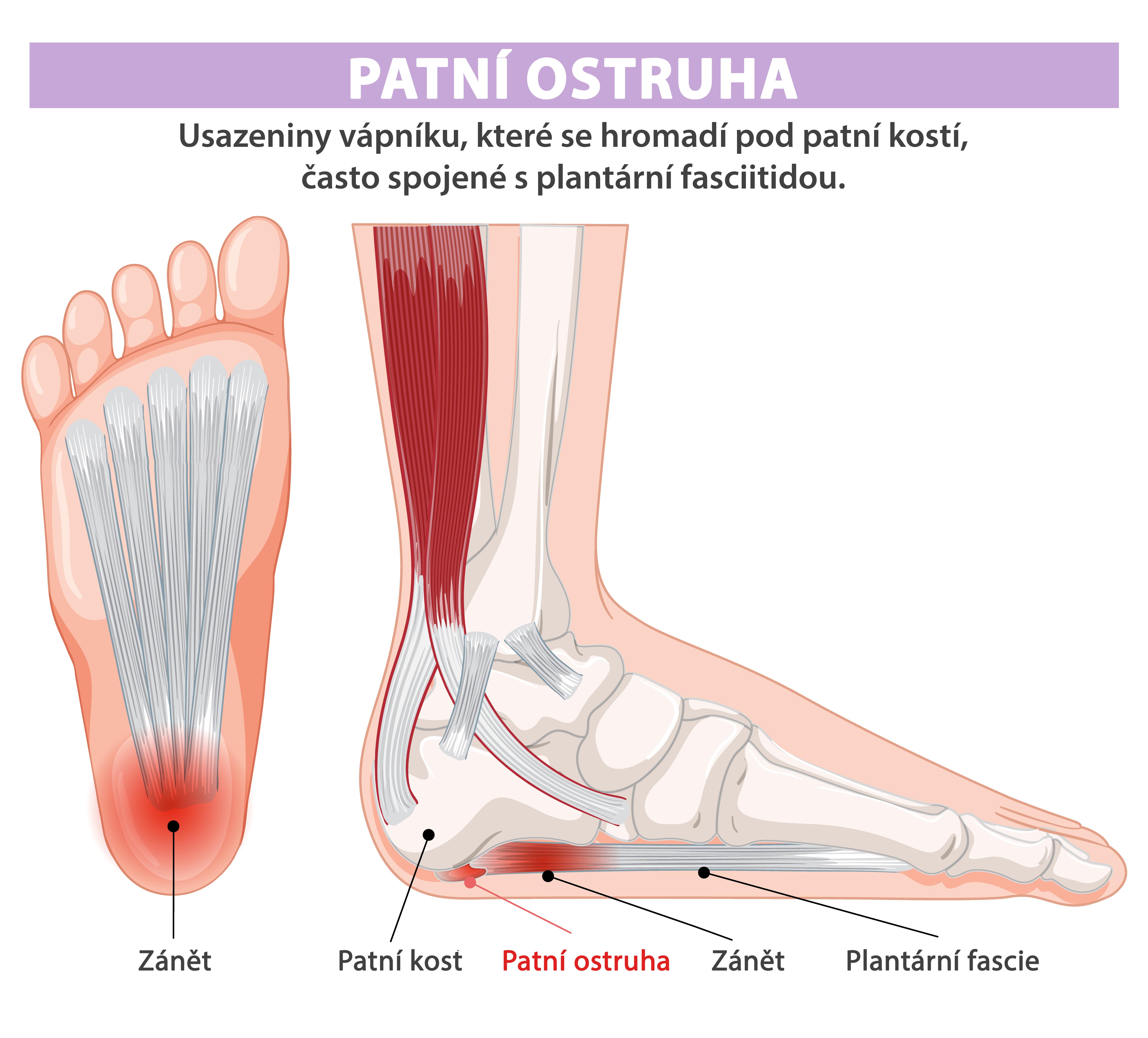 Bandáž na úleva od bolesti paty, plantární fascie a unavených chodidel pomocí tepla nebo chladu