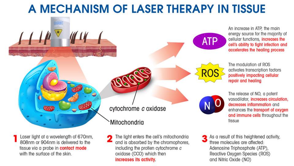 Laser_Therapy_2017