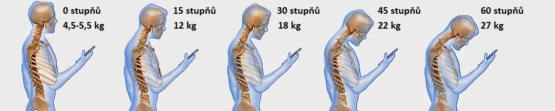 bad_neck_postureCZ1084x217