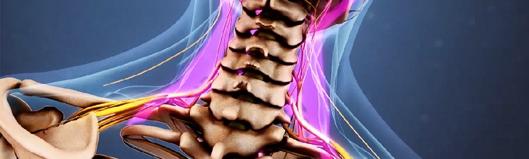 cervical_pain1084x326