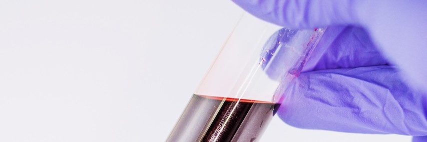 blood-1291132_1280
