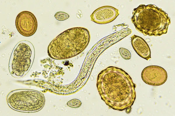 Ako správne odčerviť psa, prečo to nepodceňovať a kedy je ten správny čas