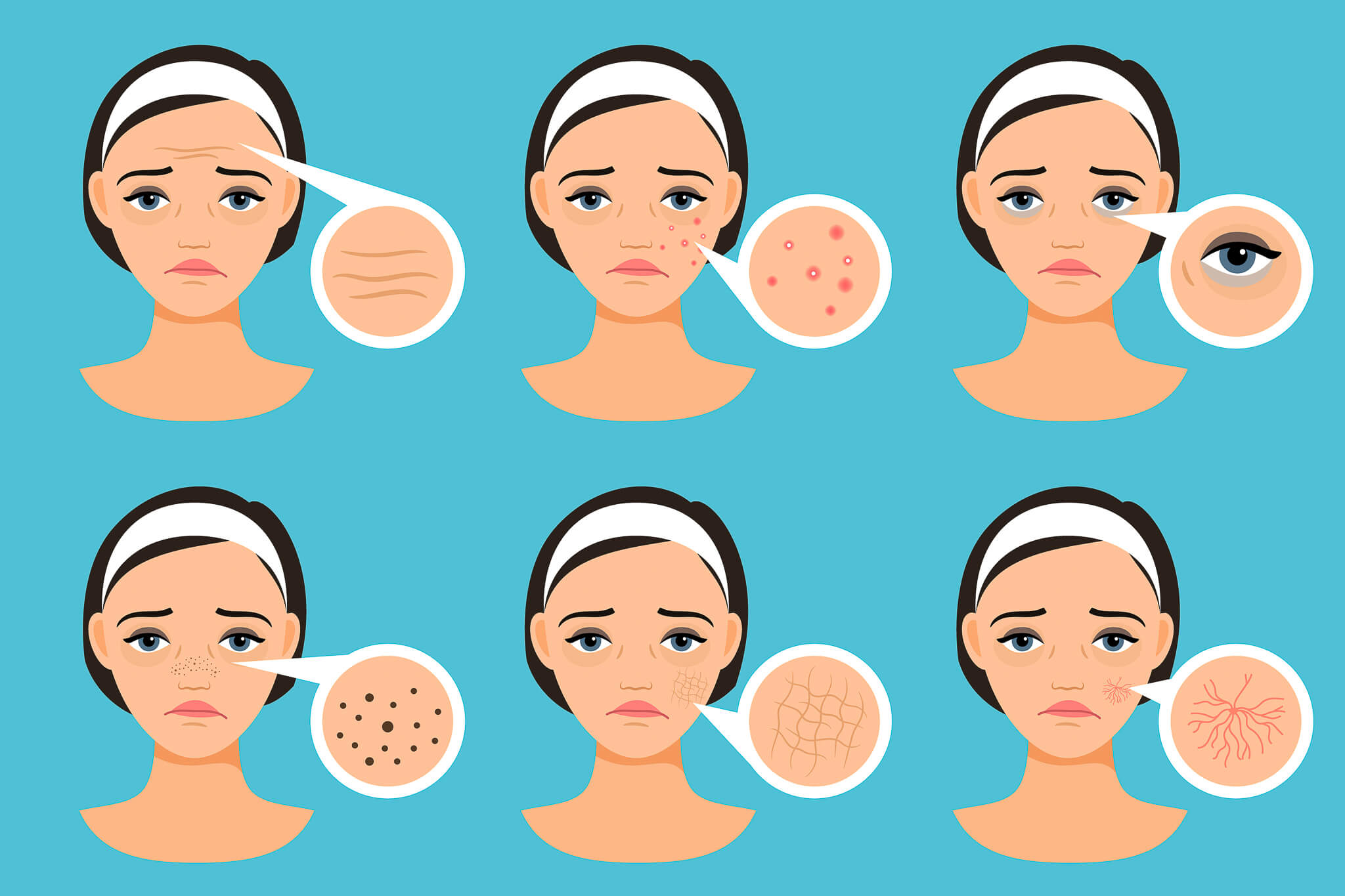 Běžné problémy s pletí - poradíme, jak je vyřešit