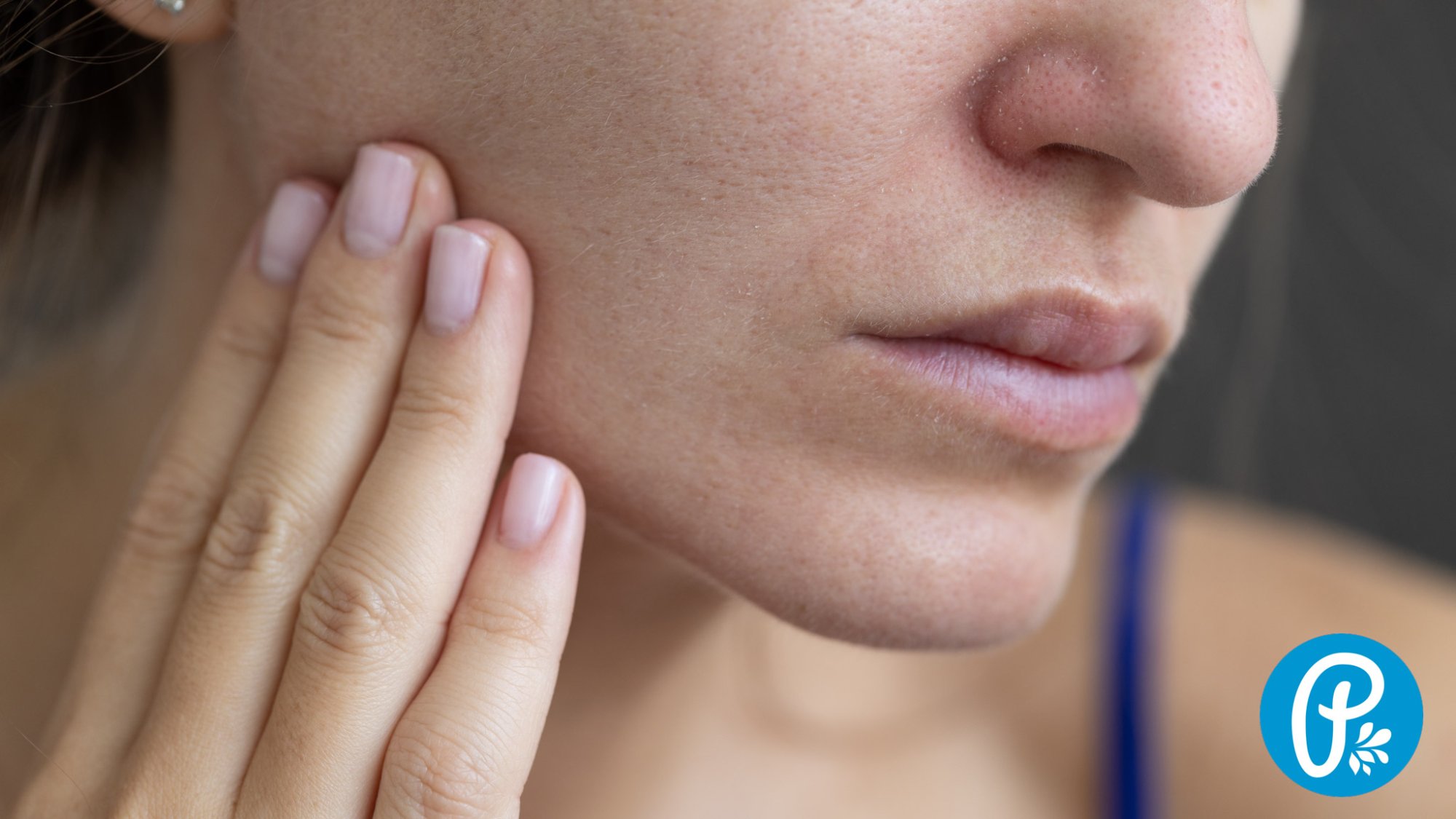 Suchá pleť - jak o ni správně pečovat