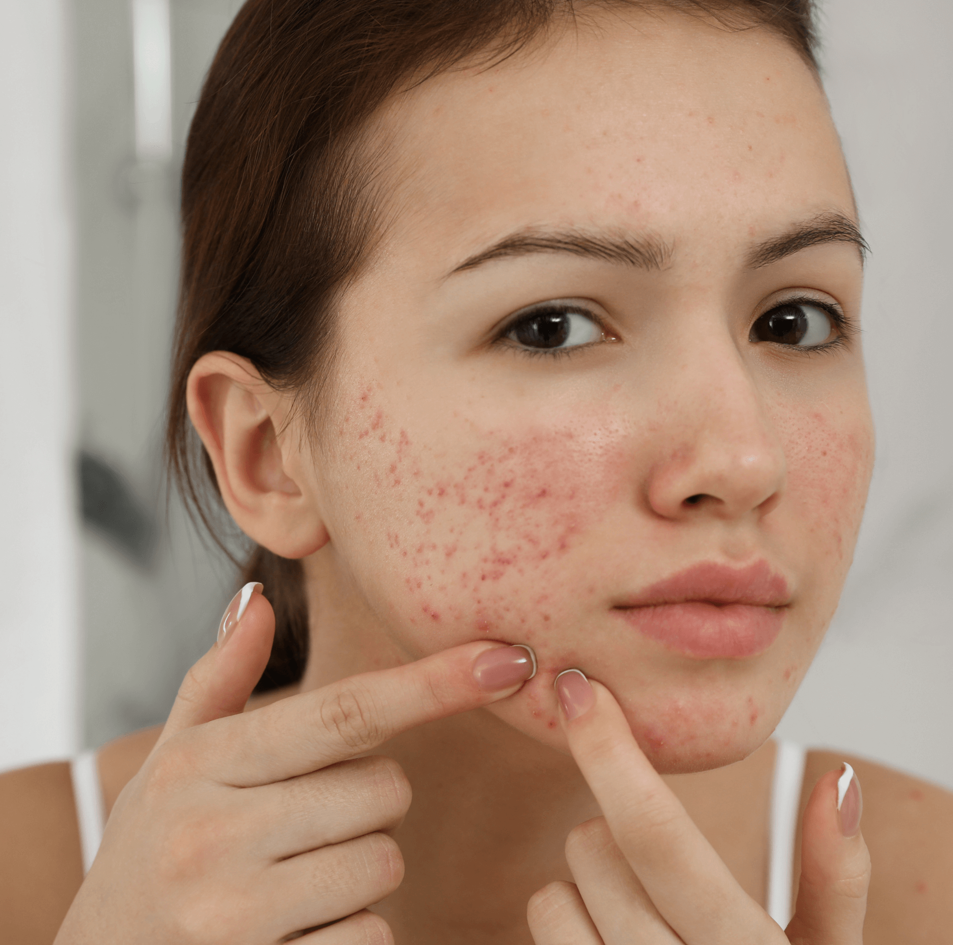 Najčastejšie začiatočnícke chyby v starostlivosti o pleť, ktorým sa musíte vyhnúť