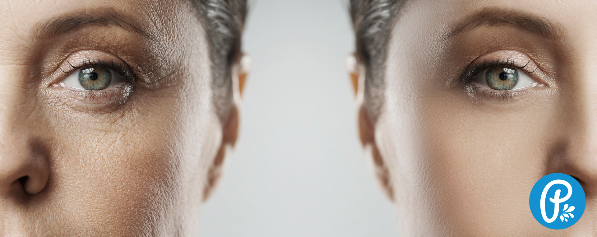 Ako zastaviť starnutie pleti silou prírody